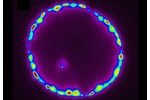 Arsenic in the plant cells X-ray picture of cross-section of hornworth leaf