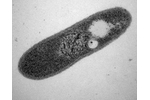 Gemmatimonas phototropica Na první pohled normální bakterie - takto vypadá G. phototropica v elektronovém mikroskopu. Zdroj: Algatech, www.alga.cz.